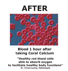 Photo of blood cells after AquaLyte treatment