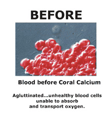 Photo of blood cells before AquaLyte treatment
